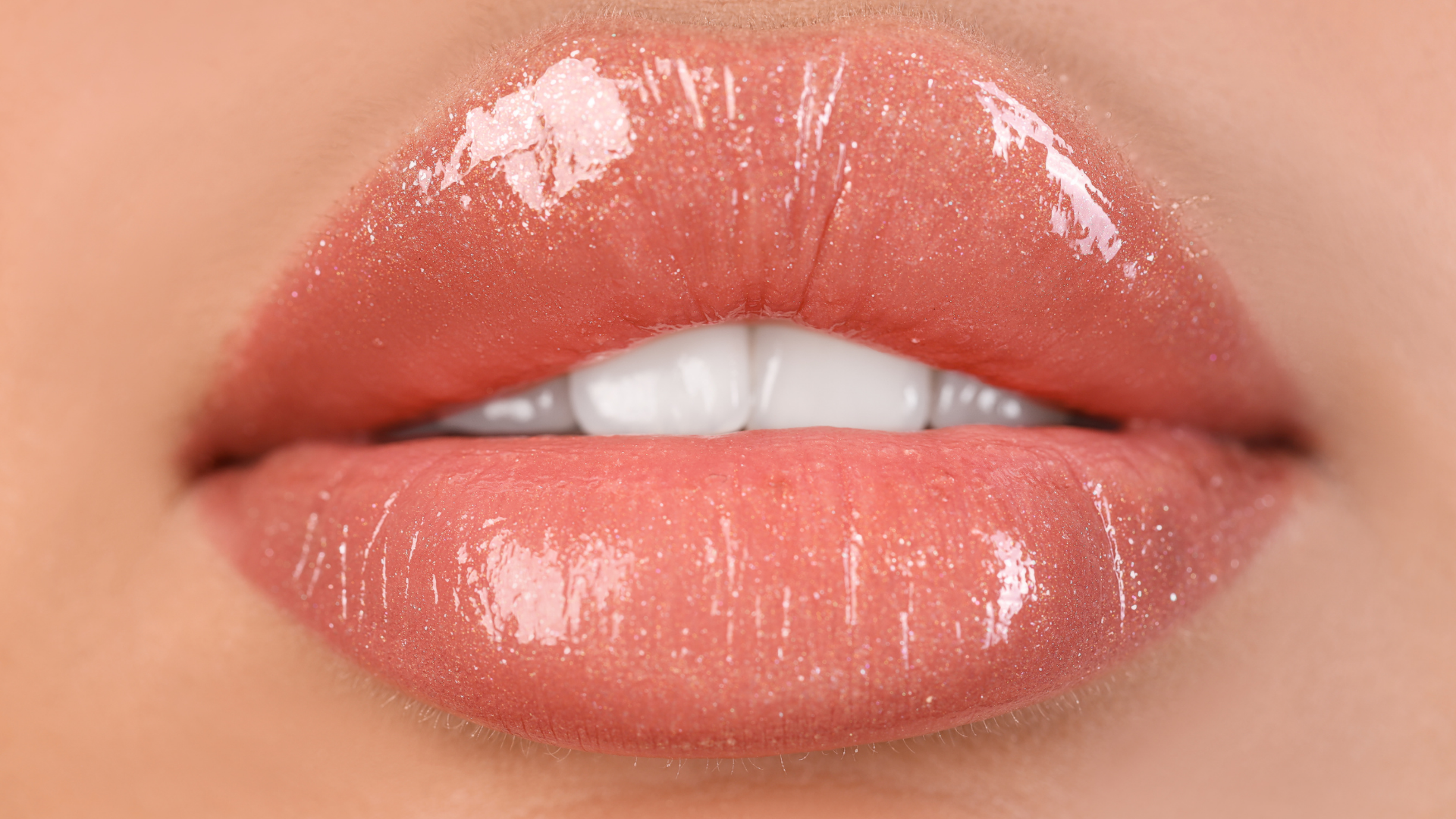 Lip Lift