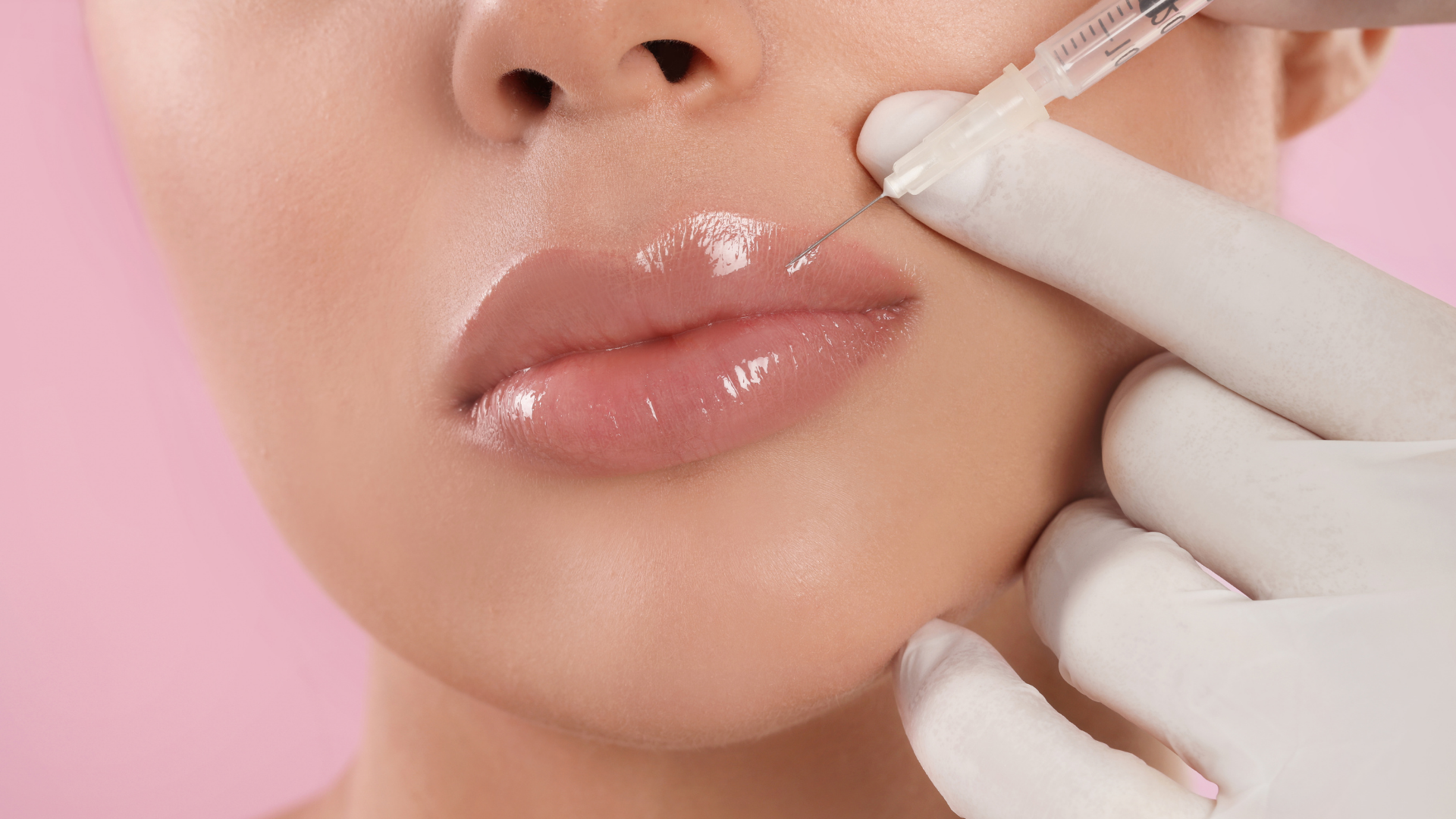 Preenchimento Labial